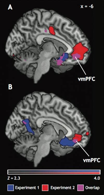 Buying And The Ventromedial Pr Image Eurekalert Science News Releases