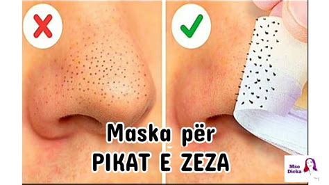 Maska Per Pikat E Zeza Si Te Heqim Pikat E Zeza Si Te Pastrojme