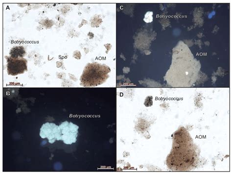 Photomicrographs Of Organic Matter Of The Original Sample A And D