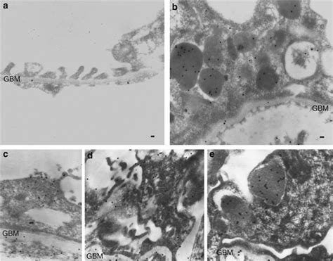 Immunogold Transmission Electron Microscopy Tem Images Labeling For