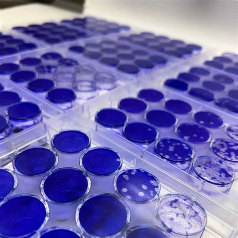 Influenza Virus Plaque Assay