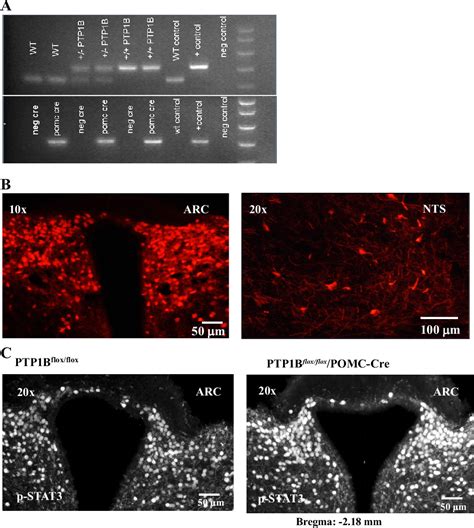 Figure 1 From Role Of Ptp1b In Pomc Neurons During Chronic High Fat Diet Sex Differences In