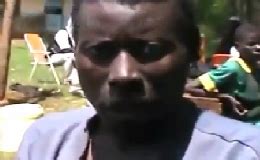 HUMAN INFECTED OF JIGGER FLEA IN KENYA