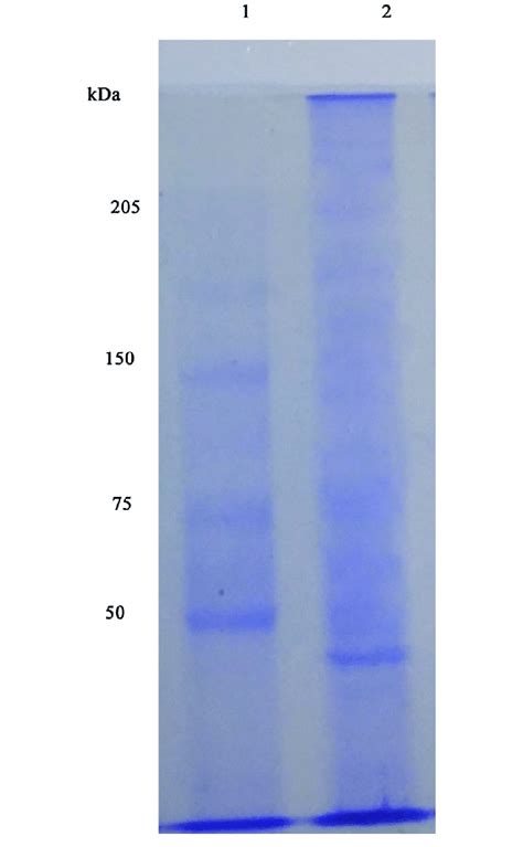 Sds Page Analysis Of Amylase By Streptomyces Sp Al Dhabi The