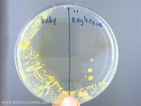 Identifying bacteria through look, growth, stain and strain – bacterial ... 