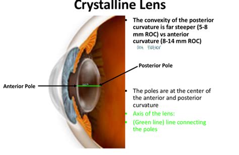 Lab Lens And Vitreous Flashcards Quizlet