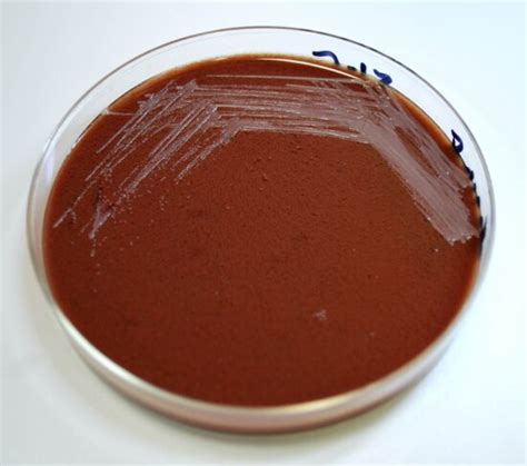 Free Picture Brucella Abortus Bacteria Blood Agar