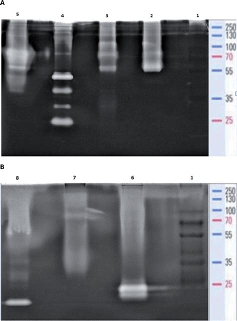 Casein Zymogram Showing Bands Of Protein Cleavage On Sds Page A