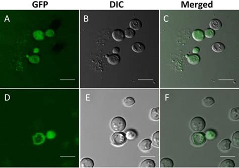 Confocal Micrographs Document Mip Gfp Expression In S Cerevisiae Download Scientific Diagram