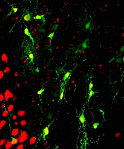 El Universo Bajo el Microscopio: Reprogramación de células gliales para ...