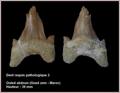 Dents De Requins Ayant Subies Des Deformations Pathologiques