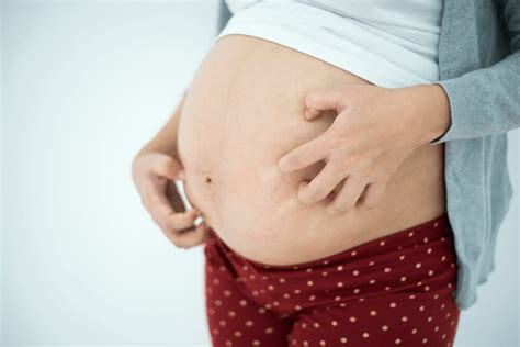 Itching in Pregnancy: When to See Your Doctor