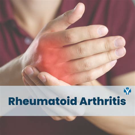 Methotrexate For Rheumatoid Arthritis Patients All Your Questions