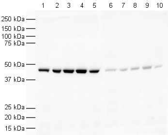 Anti-beta Actin antibody (ab8227) | Abcam