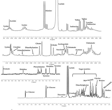 Figure 1 From Metabolomic Profiling Of Second Trimester Amniotic Fluid For Predicting Preterm