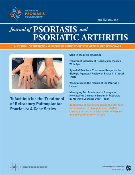 Tofacitinib For The Treatment Of Refractory Palmoplantar Psoriasis A