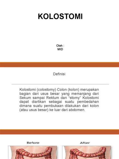 Kolostomi Definisi Anatomi Fungsi Dan Perawatan Pasca Bedah