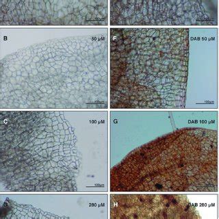 Histochemical Analysis With 3 3 Diaminobenzidine DAB As ROS