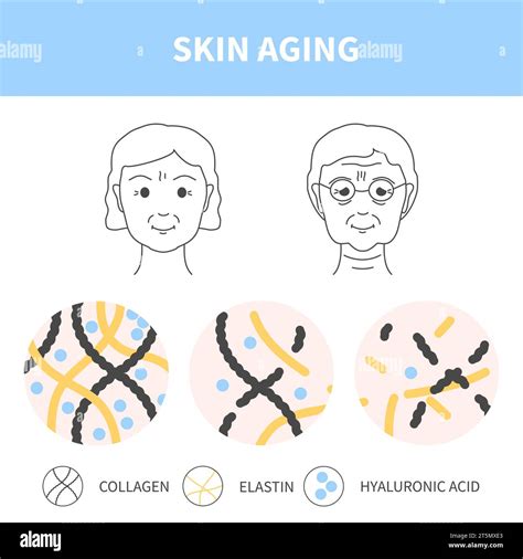 Female Skin Aging And Collagen Loss Diagram Illustration Stock Vector