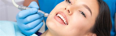 Cu Ndo Debe Durar Un Empaste Provisional Agdent Cl Nica Dental