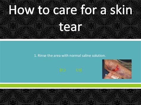 How To Care For A Skin Tear