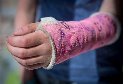 How To Tell If Your Finger Is Broken Fractures Sprains And