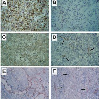 In Vivo Modulation Of Fgf Expression Nude Mice That Received