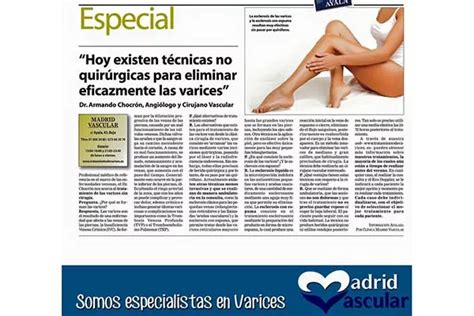 Tratamiento De Varices Sin Cirug A Madrid Vascular