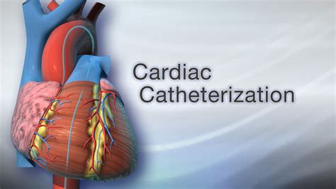 Cardiac catheterization Millions of Americans are living with heart ...