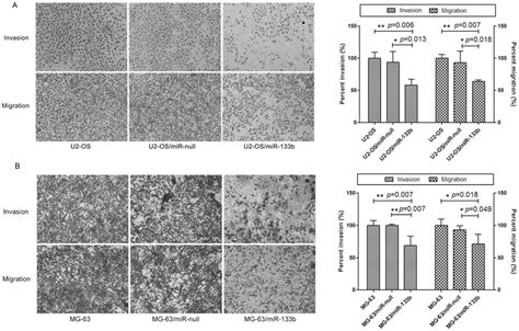 Roles Of Mir 133b In Invasion And Migration Of Osteosarcoma Cell