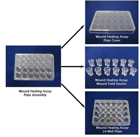 Wound healing assay protocol | Astral Projection