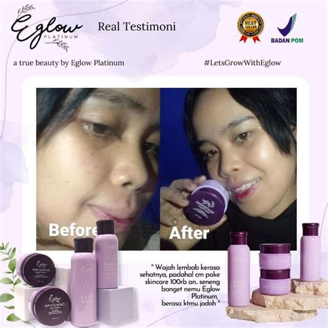 Jual Eglow Platinum Skincare Shopee Indonesia