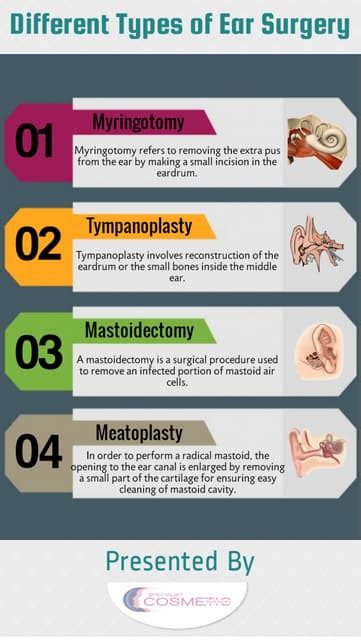 Different types of Ear Surgery | PDF