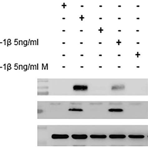 Effect Of Irak14 Inhibitor Iraki On Il 1b Induced Icam 1 And Il 8