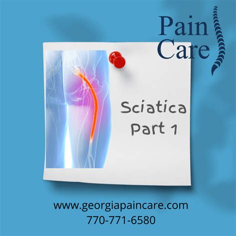 What Is Sciatica Pain Diagnosis Prevention Treatment Nbkomputer