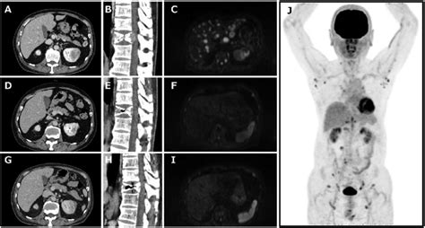 The Radiographic Images Of This Case Aec Radiographic Images At