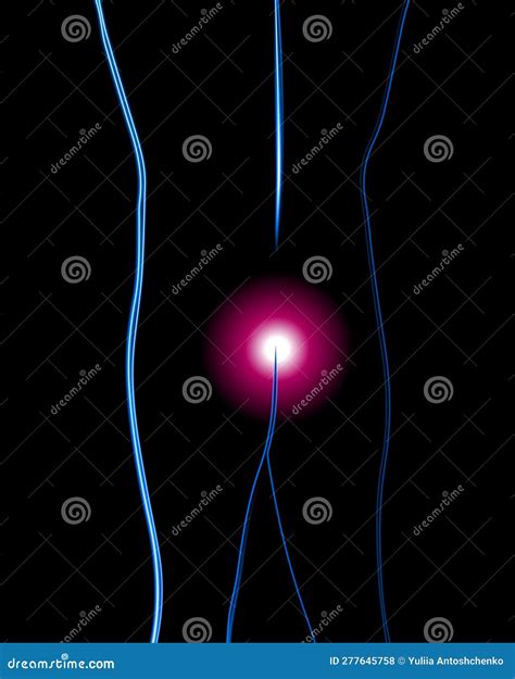 Pain In The Coccyx. Cartoon Vector | CartoonDealer.com #354413319