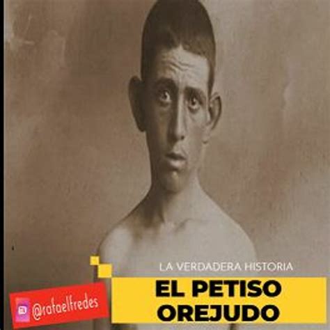 Stream La Verdadera Historia Del Petiso Orejudo By Rafael Fredes