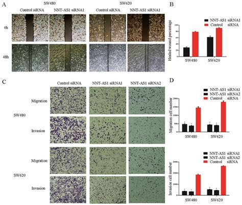 Nnt As Promotes Crc Cell Migration And Invasion In Vitro A And B