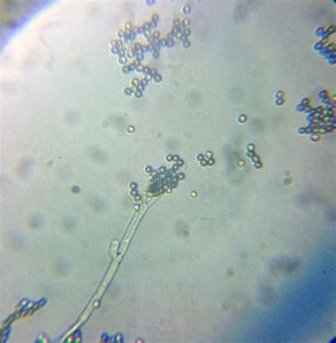 Penicillium Genus Moho Esporas Micelio Bajo Microscopio Imagen De