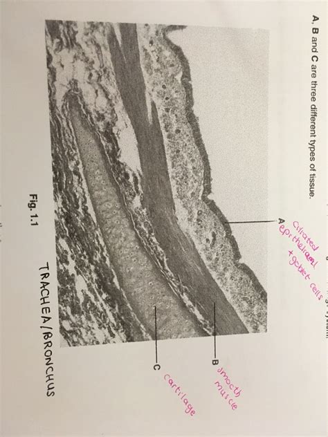 Light Micrograph Of A Section Through Part Of The Gas Exchange System