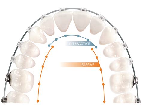 Empower Dual Activation System American Orthodontics Israel