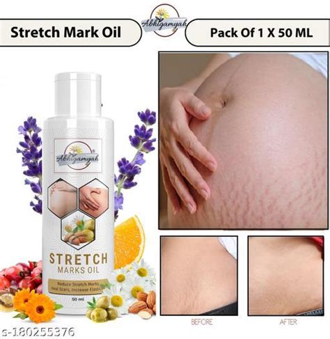 Abhigamyah Present Repair Stretch Marks Removal Natural Heal