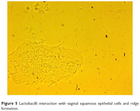 Vaginal Lactobacillus Biofilm Formation In Vivo Clinical Impl Ijwh