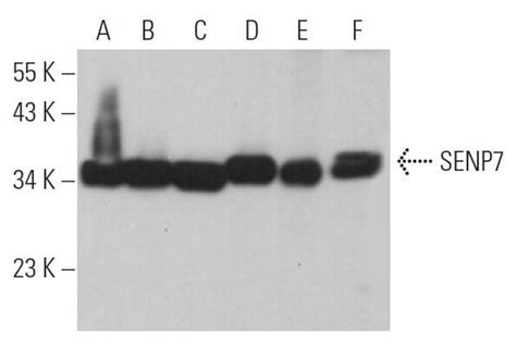 Senp E Scbt Santa Cruz Biotechnology