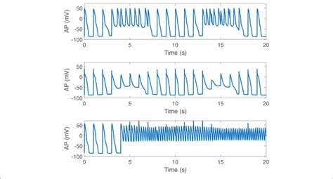 Pro Arrhythmic Events Observed Following Sp In Cells Under Simulated