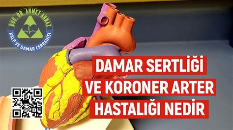 Damar Sertli I Ve Koroner Arter Hastal Nedir Do Dr Ahmet Arnaz