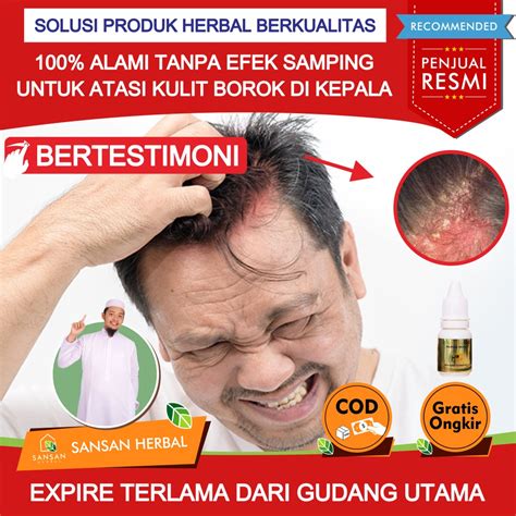 Jual Salep Borok Kepala Di Apotik Salep Borok Kepala Bernanah Salep