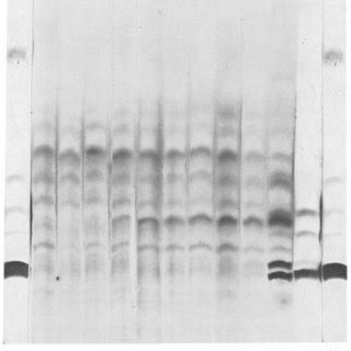 Autoradiography Of 35S Labelled Polypeptides Of Uninfected Cells C