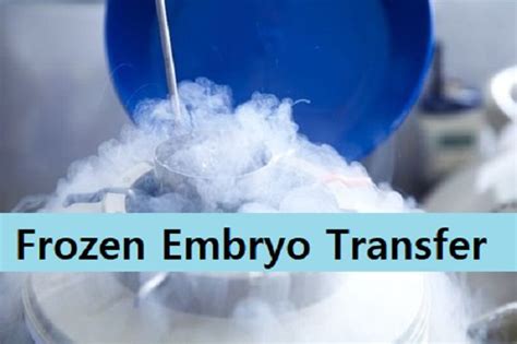 Things To Know About Frozen Embryo Transfer Procedure